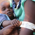 Uncovering the Hidden Threat of Malnutrition in Our Community